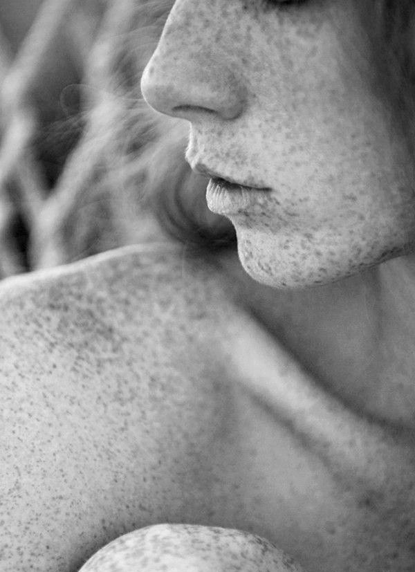 Les t�ches de rousseurs, une irr�sistible coquetterie naturelle !