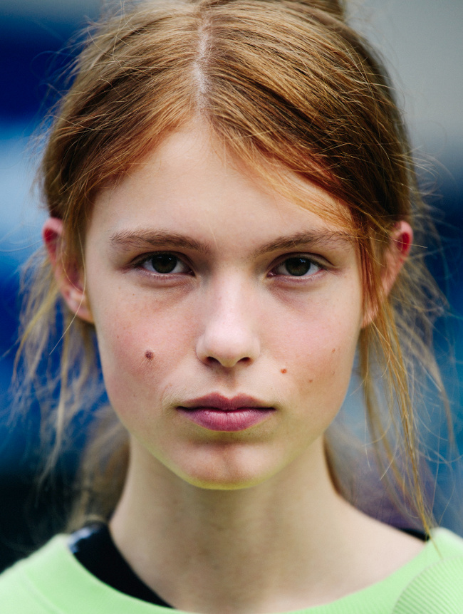 Les grains de beaut�, ces fac�ties heureuses de la nature !