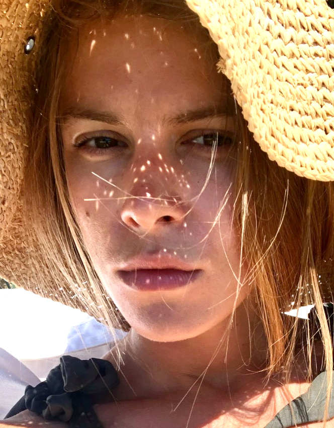 Wanted : quelques taches de rousseur �ph�m�res !