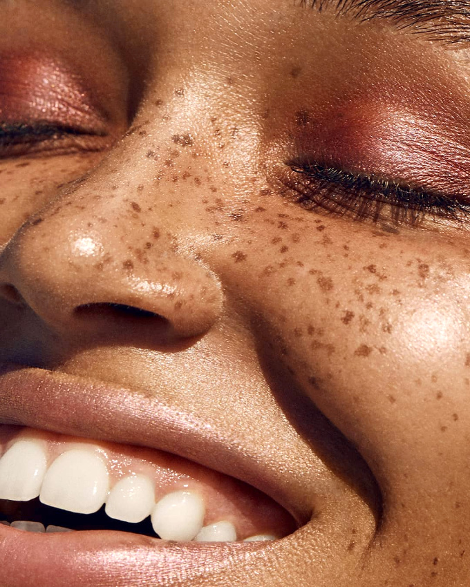 Taches de rousseurs + �clat de rire = le bon mix