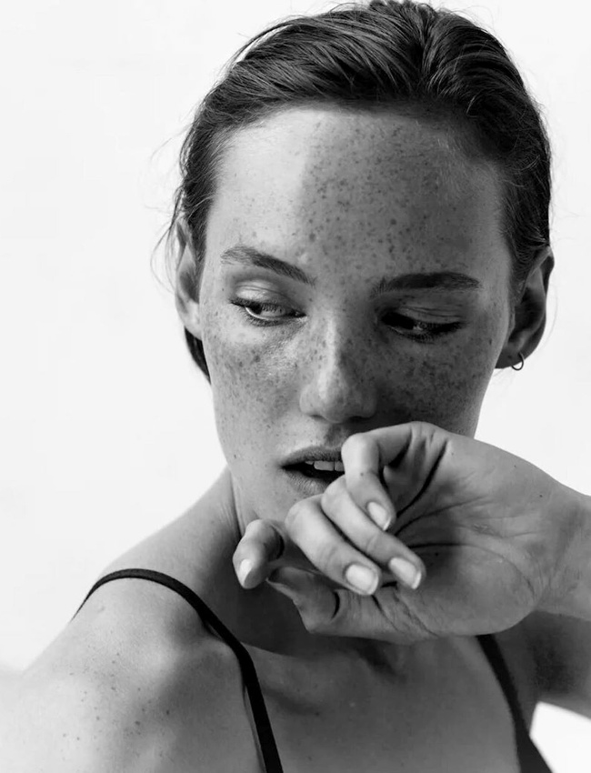 Les taches de rousseurs, la coquetterie ultime !