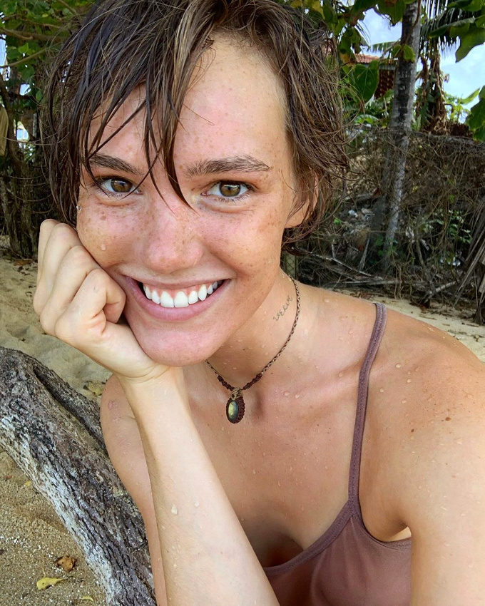 Les taches de rousseur apparaissant avec le soleil : un des petits plaisirs de l'�t� !