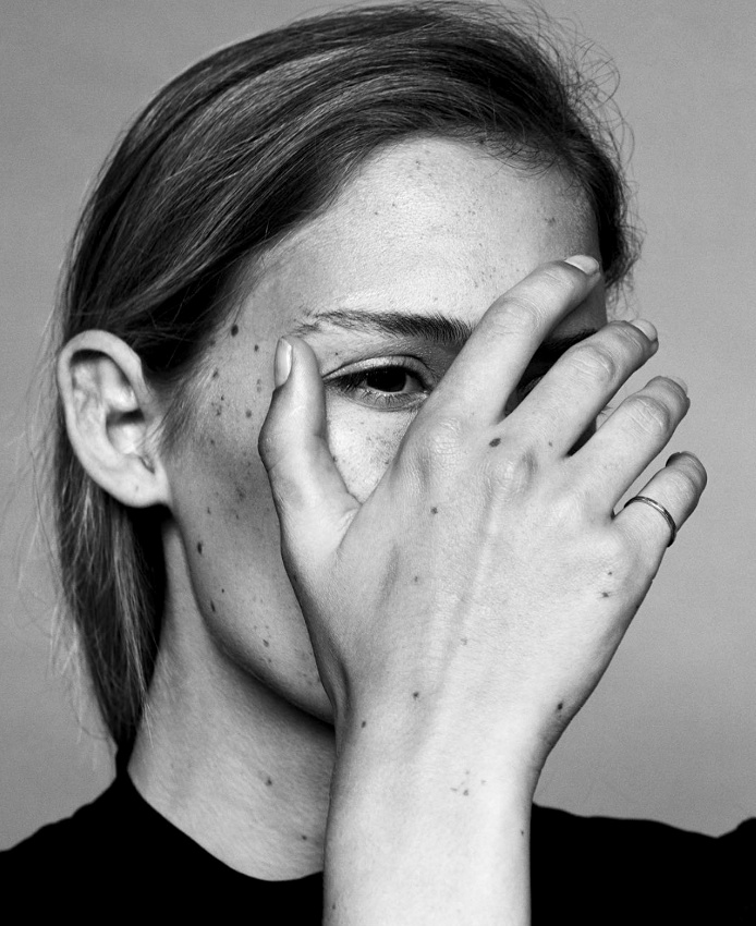 Les bien nomms grains de beaut...