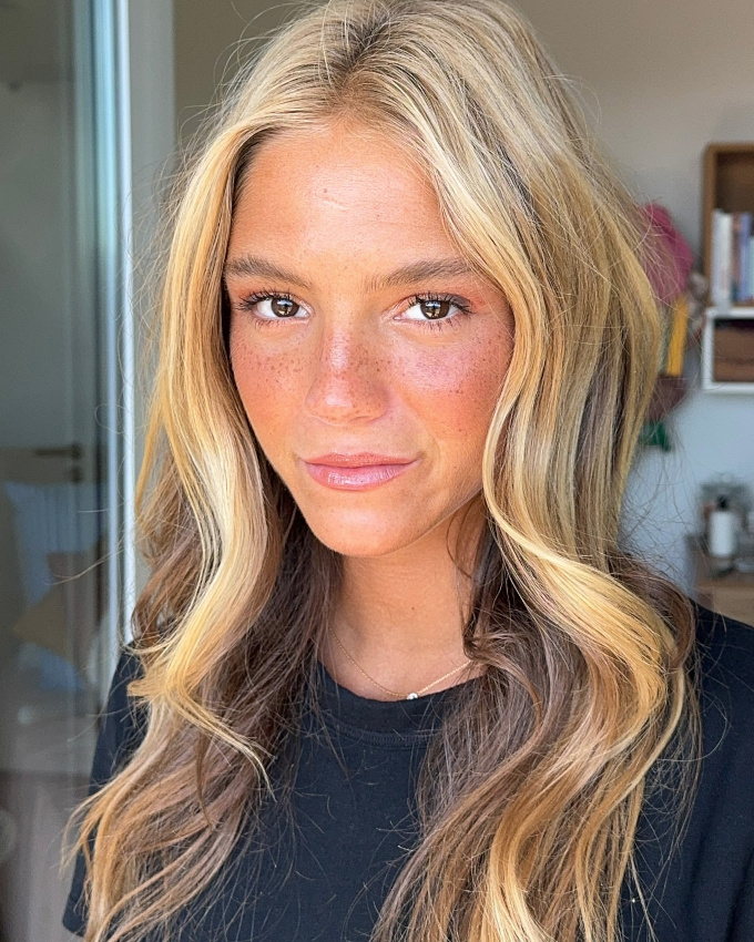 Les taches de rousseur : l'atout charme par excellence !